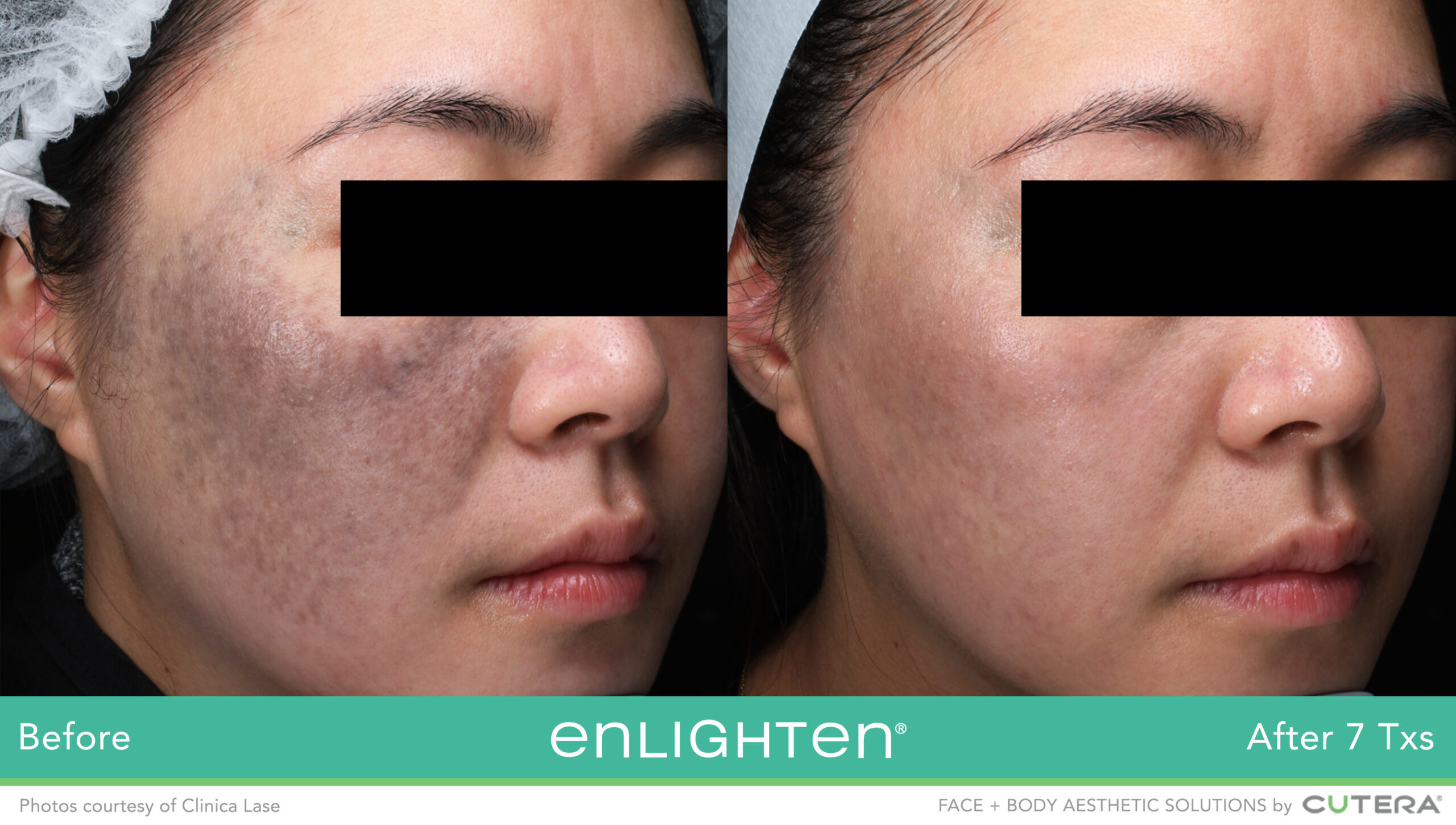 07_enlighten_B&A_Clinica