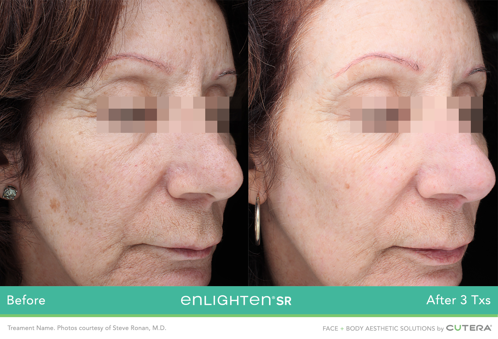 enlightenSR-Steve-Ronan-MD-S5_highres