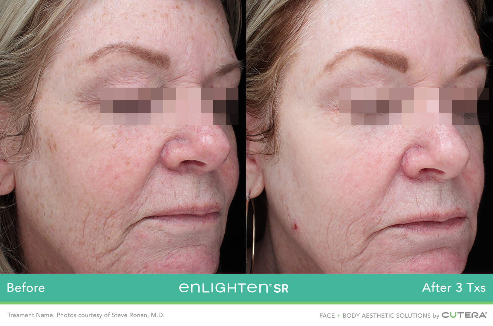 enlightenSR-Steve-Ronan-MD-S6_highres